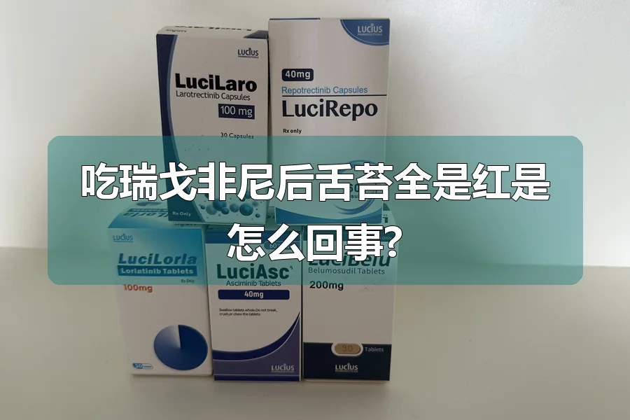 吃瑞戈非尼后舌苔全是红是怎么回事?